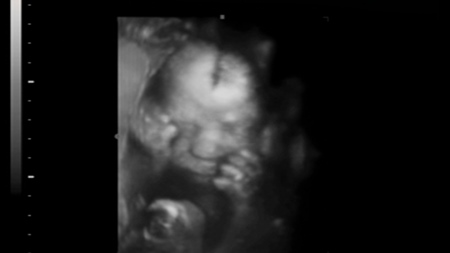 妊娠27週　胎児　エコー　4D超音波　写真
