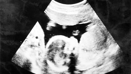 妊娠28週　胎児エコー　超音波　写真