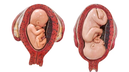胎児の逆子や胎位