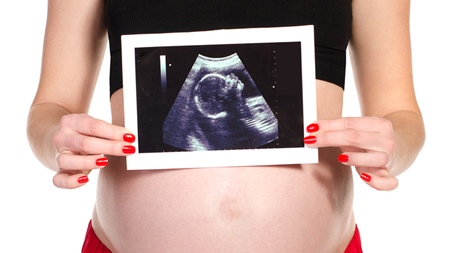 妊婦　胎児　エコー　超音波　写真