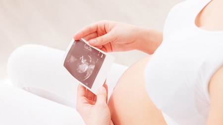 妊娠21週エコー　超音波　妊婦　写真
