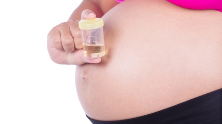 妊娠中に尿たんぱくが多い理由とは？