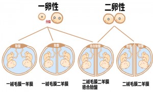 双子（多胎妊娠）とは