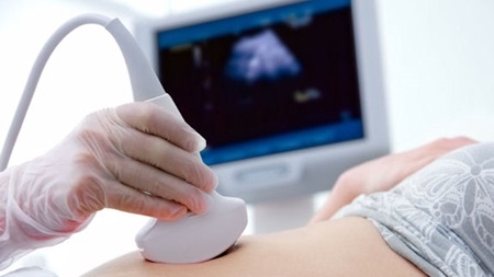 胎児の状態の検査について