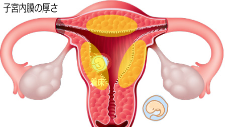 子宮内膜の厚さも妊娠確定の条件になる場合も