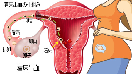 チクチク 下 妊娠 初期 腹部