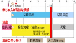 流産とは